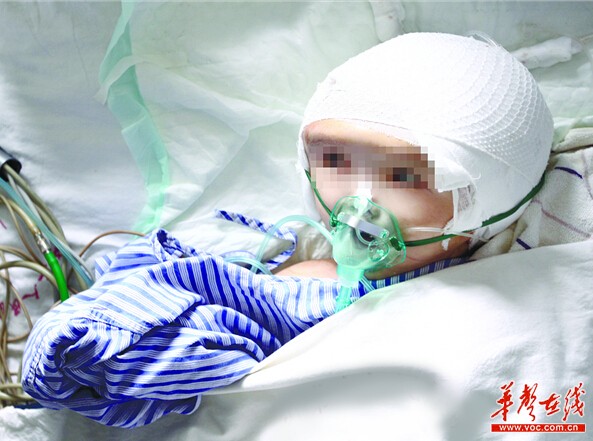 7月15日，涵涵在ICU病房接受康复治疗，她的头颅已经明显变小。记者 赵持 摄